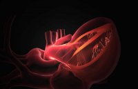 Awake Heart Valve Replacement Lets Patients Go Home Next Day