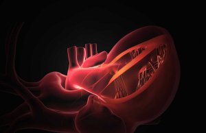 Awake Heart Valve Replacement Lets Patients Go Home Next Day