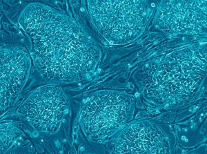 Stanford Researchers Test Stem Cell Vaccine Against Tumors in Mice