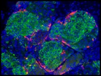Salk Scientists Grow Mature Human Insulin Cells, Reverse Diabetes in Lab Mice